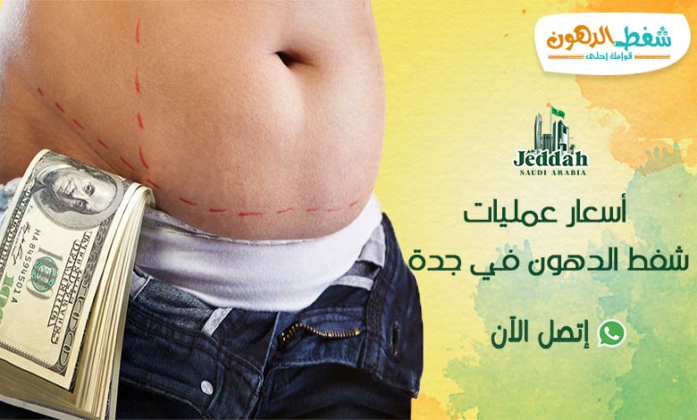 تفاصيل وأسعار عمليات أسعار عمليات شفط الدهون في جدة وأشهر 8 مراكز وأطباء