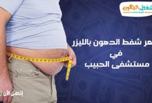 كم تكلف عملية شفط الدهون في مستشفى الحبيب