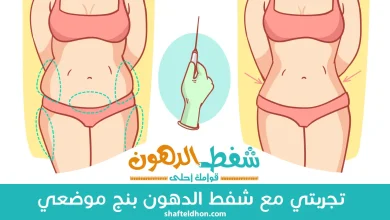 تجربتي مع شفط الدهون بنج موضعي