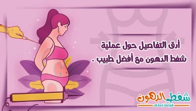 عملية شفط الدهون liposuction