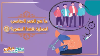 العمر المناسب لعملية شفط الدهون