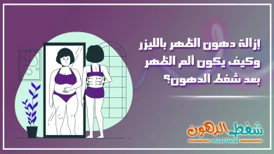 إزالة دهون الظهر بالليزر