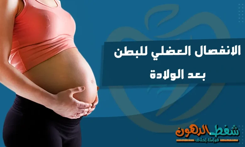 الانفصال العضلي للبطن بعد الولادة